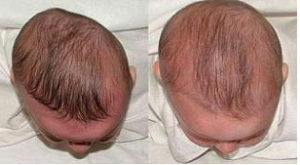 osteopatia-cranio-sacrale