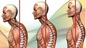 osteopatia-e-postura